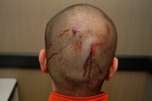 The back of George Zimmerman's head
