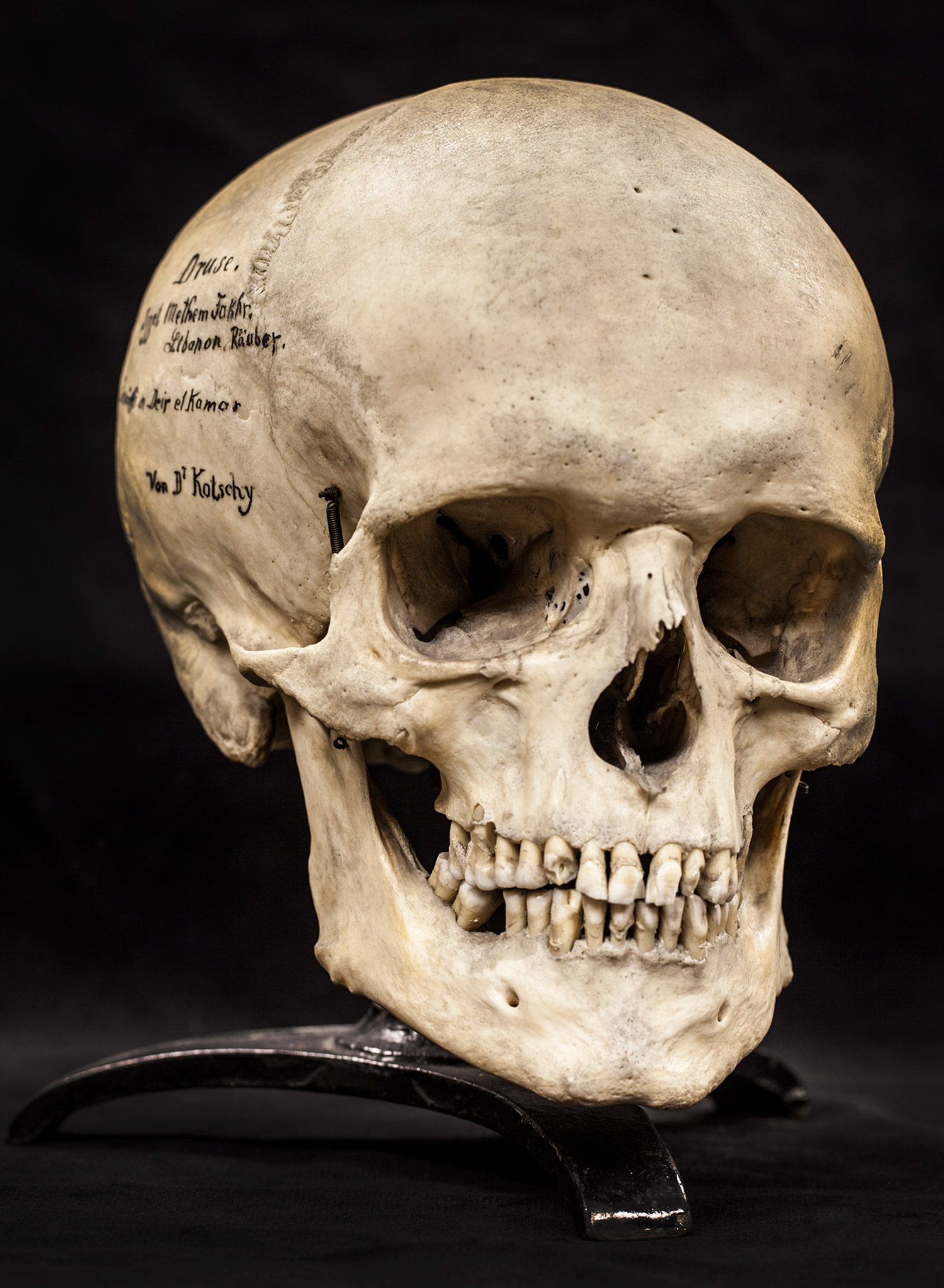 Christmas Gift Ideas: Human Skulls From the Mutter Museum | TIME.com