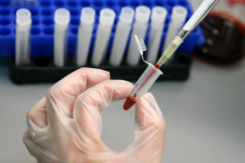 A laboratory technician examines blood samples for HIV/AIDS in a public hospital in Valparaiso city