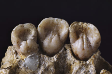 Hominid Teeth 