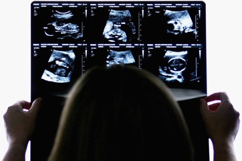 Woman with Sonogram