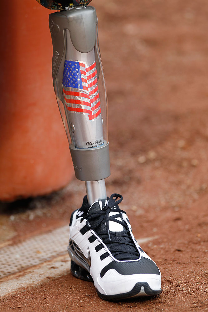 Prosthetic Leg Prosthetics Through the Years Ingenius Devices Mimic