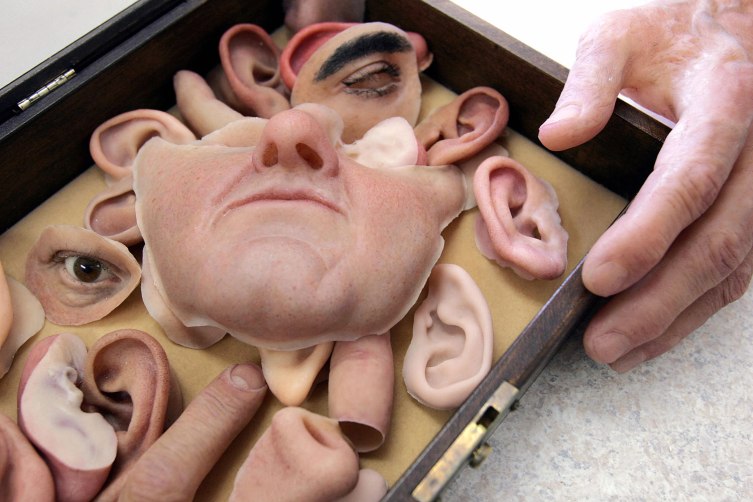 Facial Prosthetics Prosthetics Through the Years Ingenius Devices