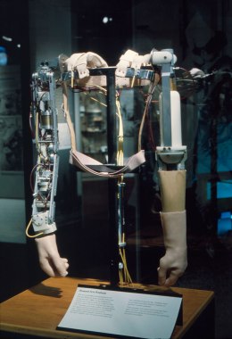 Thalidomide prosthetic arms, early 1960s.