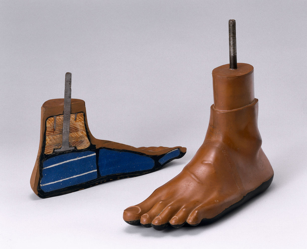 Jaipur Foot, Interior View | Prosthetics Through The Years: Ingenius ...