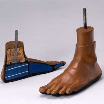 Jaipur artificial foot, 1981.