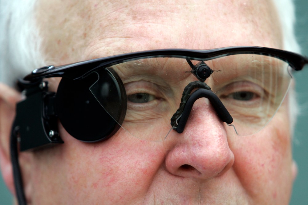 Bionic Eye Helps The Blind To Partially See Time Com