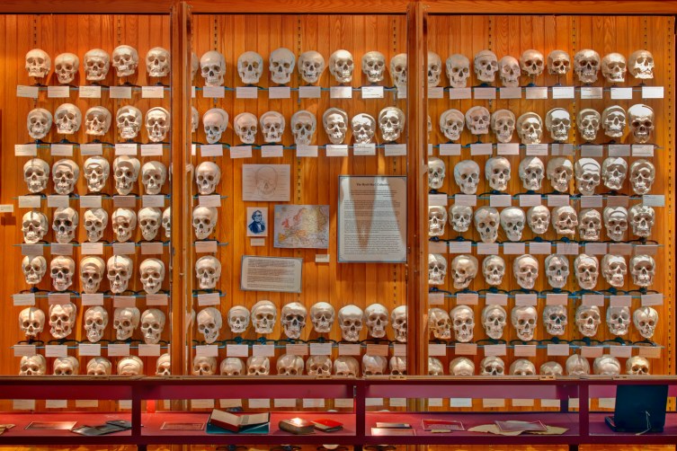 Human Skulls From the Mutter Museum